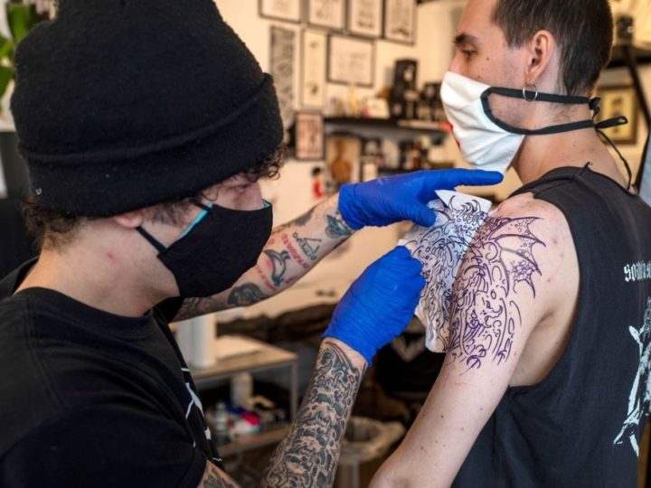 Everything You’ve Ever Wanted to Know About Tattoo Removal