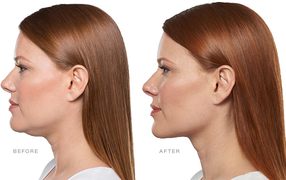 AboutKybella - Latest Fashion & Lifestyle Trends
