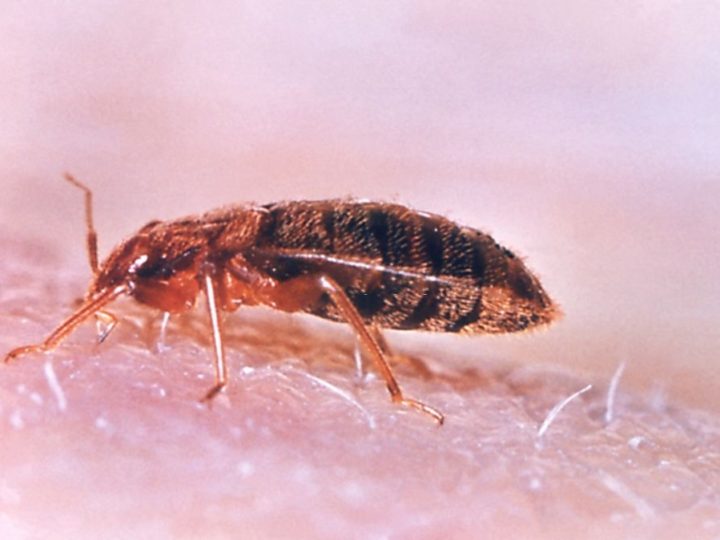 All You Need to Know About Bed Bug Bites