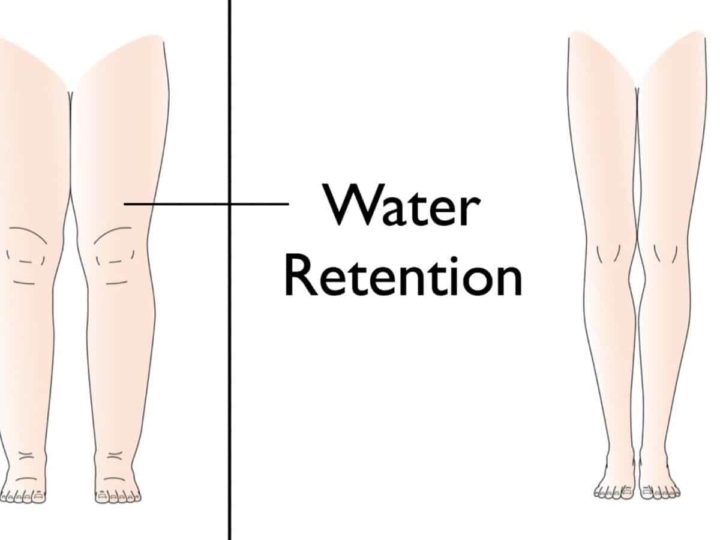 What is Water Retention? Know All About the Same!