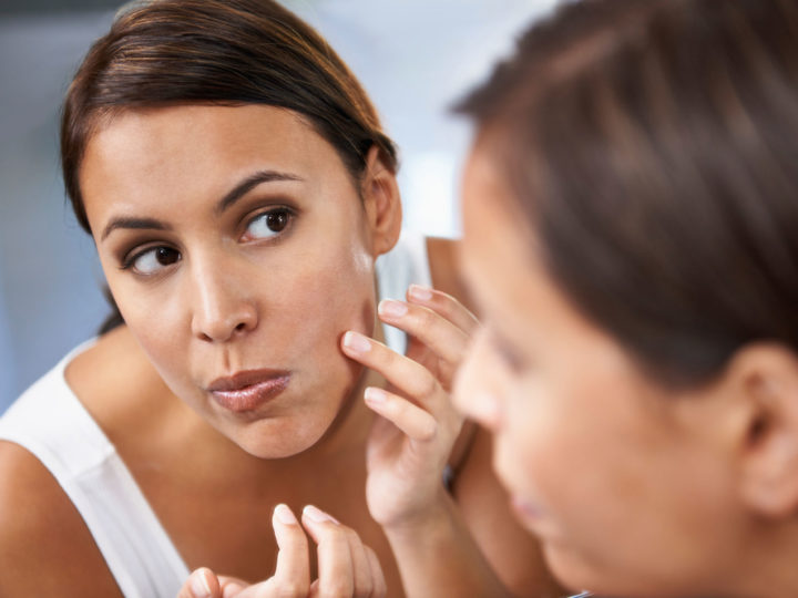 Natural Ways To Get Rid Of Acne Scars And Pimples