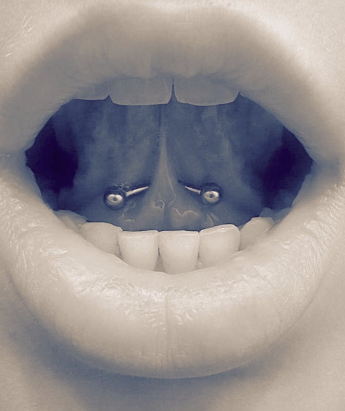 tongue web piercing