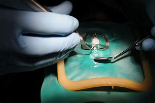 OIP.CTUNiiNsTPTuSM449qNJTQHaE6 - Latest Fashion & Lifestyle Trends Endodontist