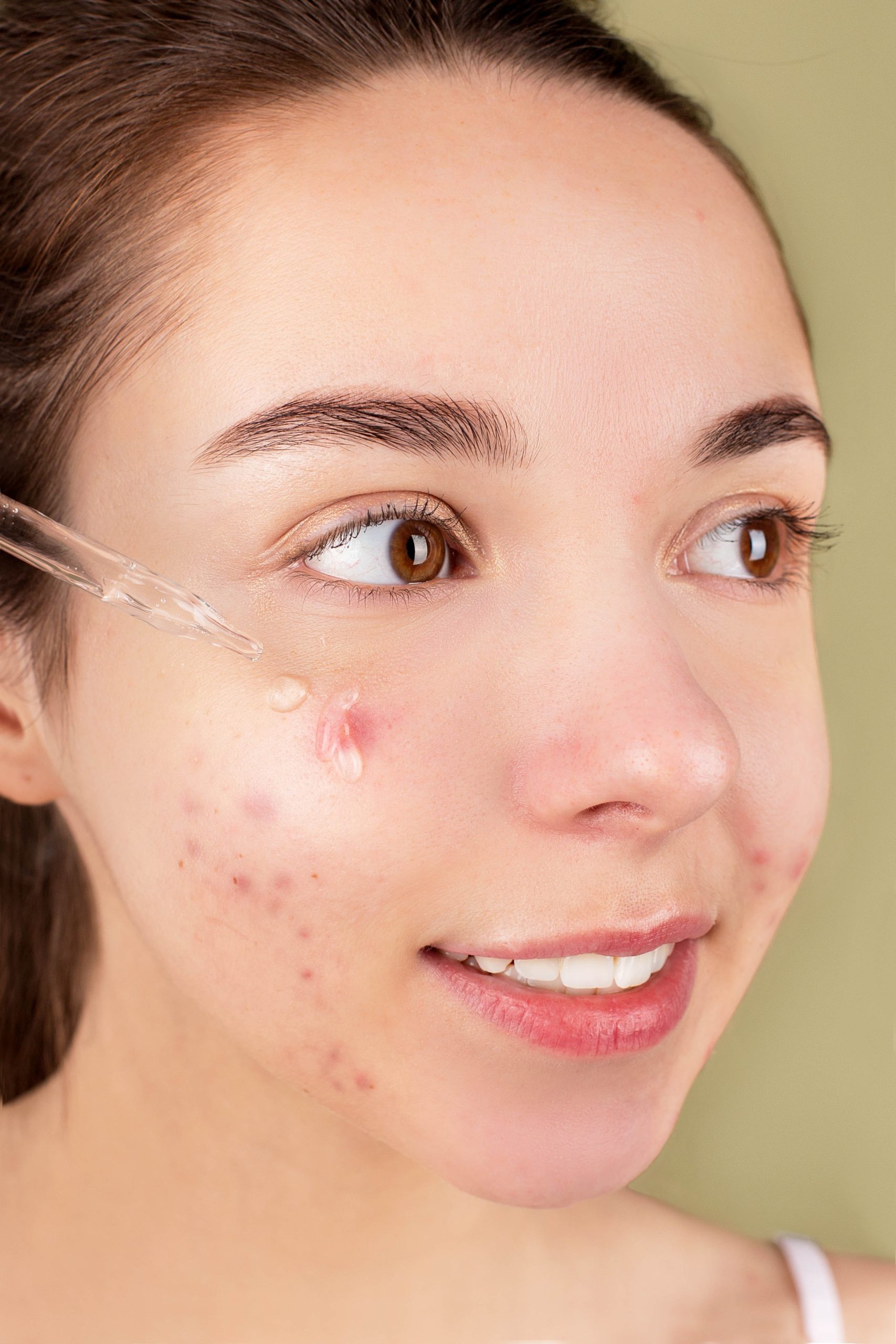 pexels-anna-nekrashevich-6476077 - Latest Fashion & Lifestyle Trends hyaluronic acid for acne